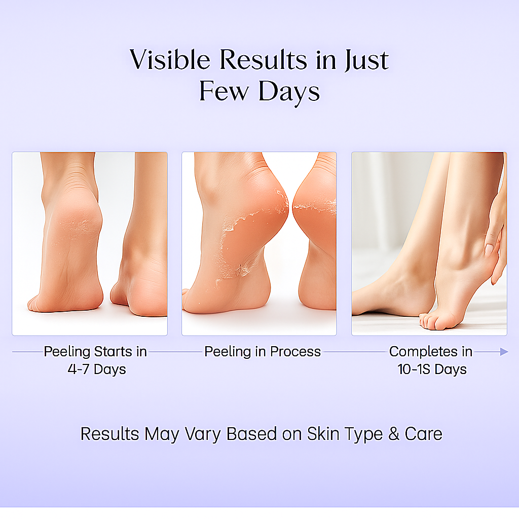 Lavender Foot Peel Mask (Pair of 2) – Natural Exfoliator for Dead Skin & Callus Removal, Heels Repair, Cracked Feet Treatment, Peeling Foot Mask for Baby Soft & Smooth Feet